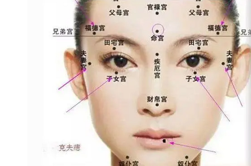 女人少见的极富贵痣女人脸上的痣图 女人少见的极富贵痣腋窝周围长痣很幸运