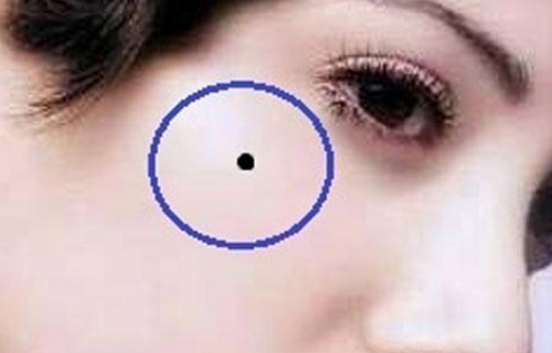 女人少见的极富贵痣女人脸上的痣图 女人少见的极富贵痣腋窝周围长痣很幸运