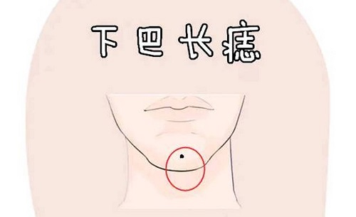 女人右下巴有痣代表什么意思 女人下巴右侧有痣好吗