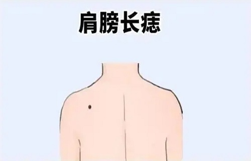 肩上有痣代表什么含义 肩上有痣的人好不好