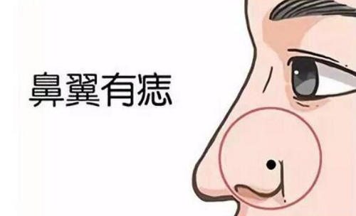 女人鼻子上的痣图解 女人鼻子上的痣图解和位置