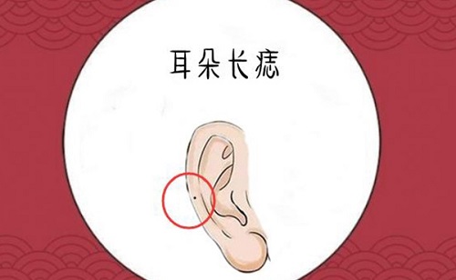 女人耳朵上长痣面相图 女人耳朵上有痣代表什么命运 女人耳朵上长痣面相图 女人耳朵上有痣代表什么命运