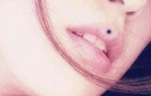 女人少见的极富贵痣女人脸上的痣图 女人少见的极富贵痣腋窝周围长痣很幸运