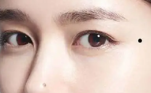 妨夫痣是什么意思 妨夫痣是什么意思图片