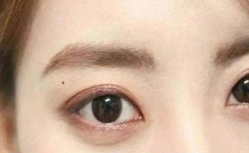 左眼皮上有痣的女人好不好呢 女人左眼皮上长有痣代表什么意思
